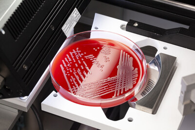 Copan 系統會為培養皿擷取高解像度影像，以進行數碼評估。